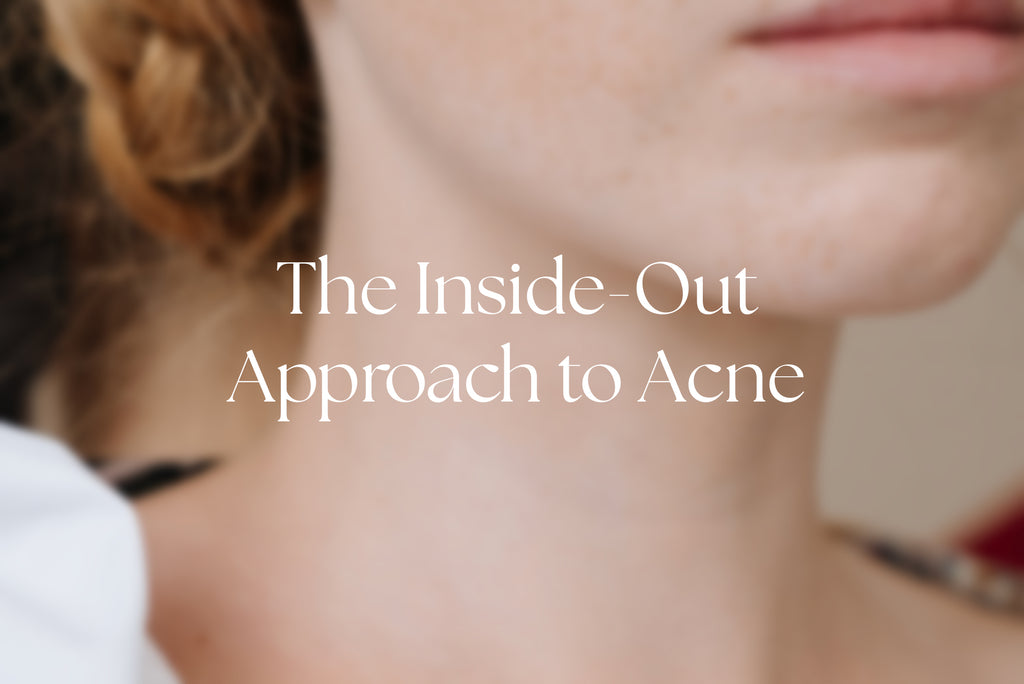 Healing Acne from the Root